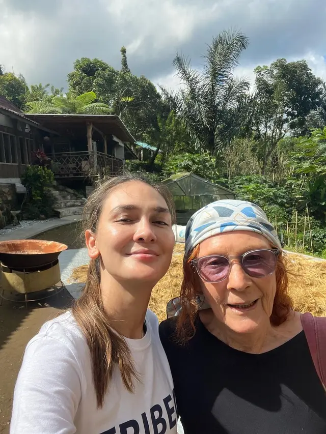 Luna Maya Cerita Ibunya Dioperasi Pakai BPJS, Biaya Tembus Rp 100 Juta